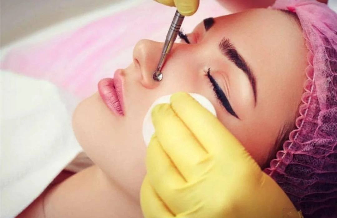 Чистка лица от 2000-2500 ₽