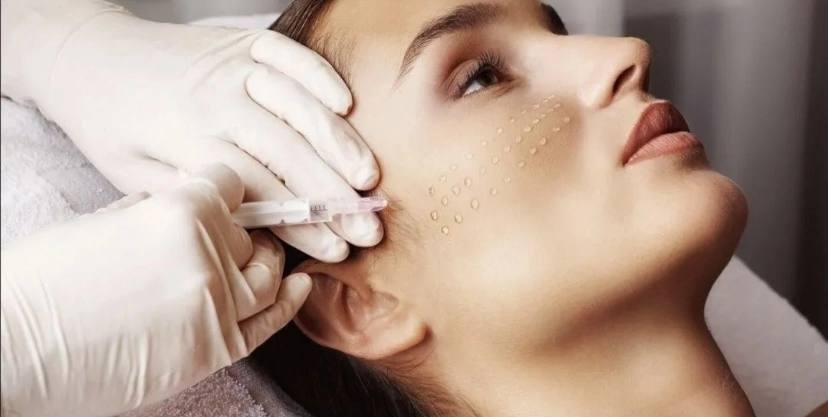 Биоревитализация лица