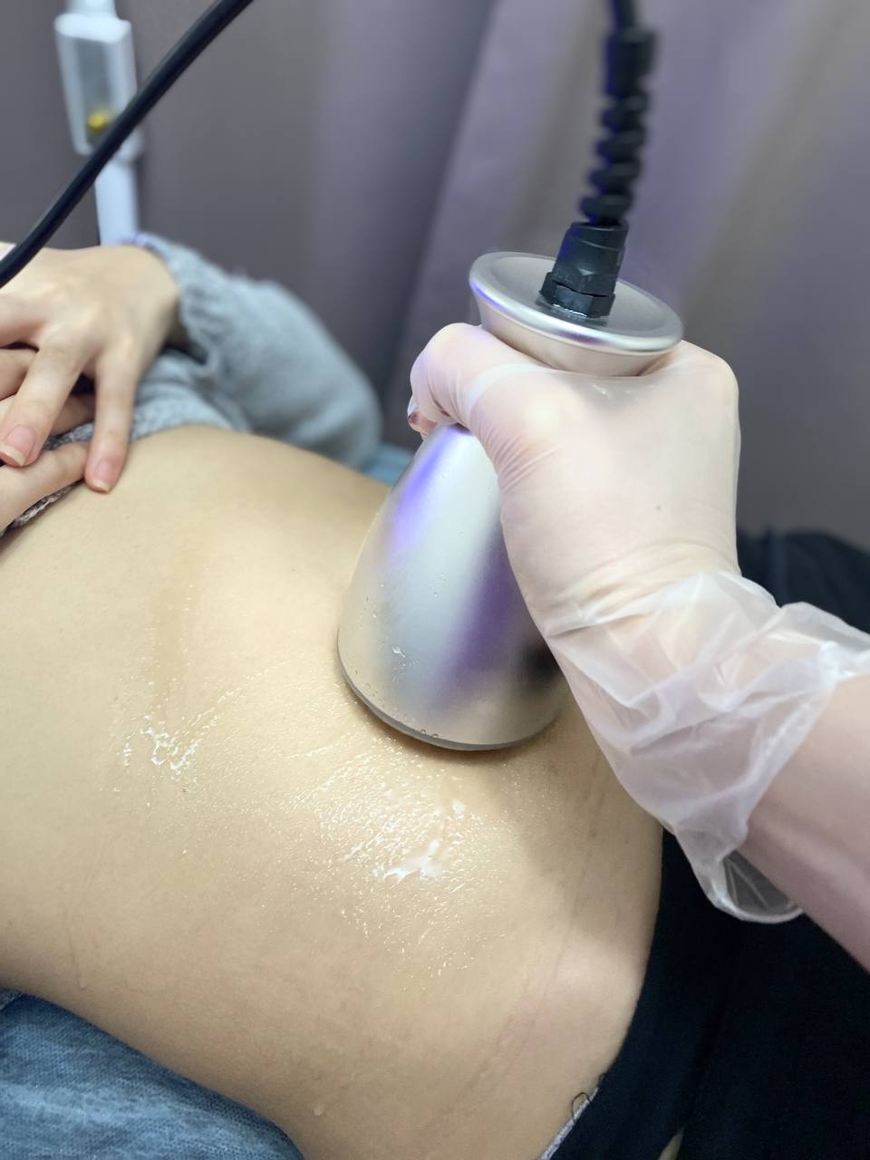 Кавитация (аппаратная процедура для уменьшения жира)