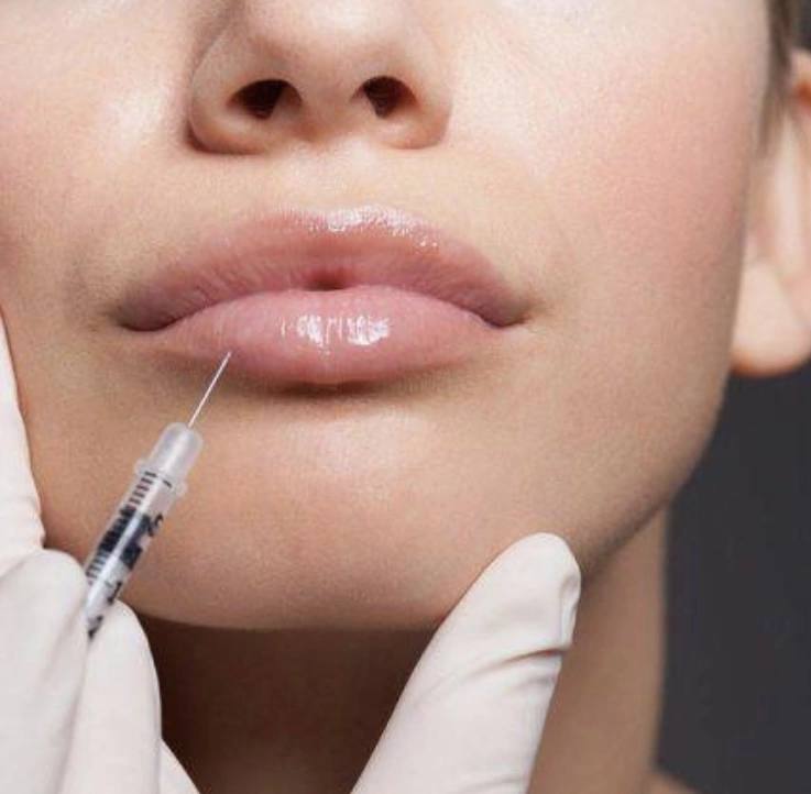 Выведение филлера из губ